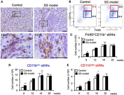 CCL22-Producing Resident Macrophages Enhance T Cell Response in Sjögren's Syndrome